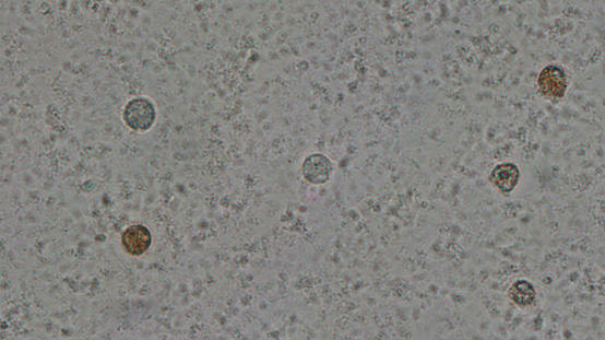 Διαφοροποίηση στρογγυλών κυττάρων