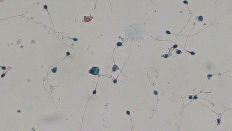 Μικροστρογγυλοκεφαλία