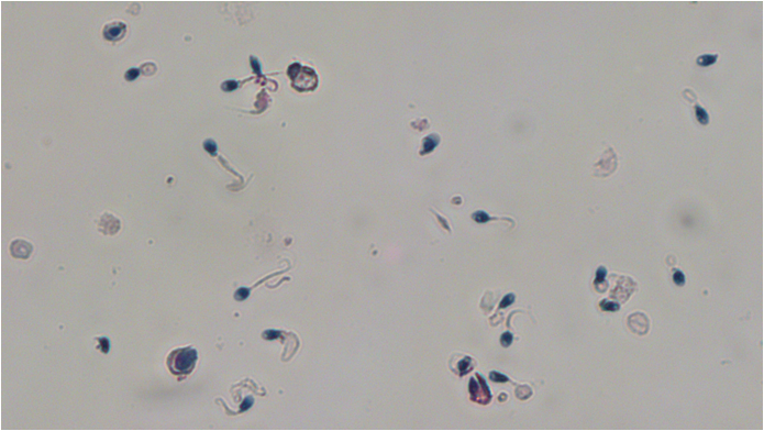 Σύνδρομο της κοντής ουράς