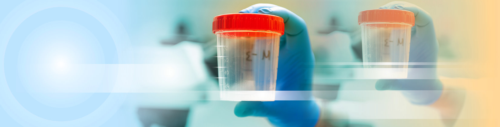 Ανδρολογικό εργαστήριο Ζεγκινιάδου μικροβιολογία σπέρματος