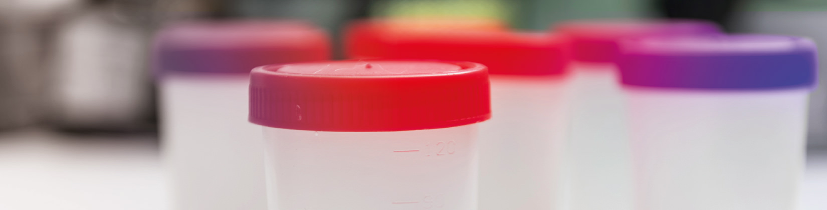 Aνδρολογικό εργαστήριο σπερμοδιάγραμμα