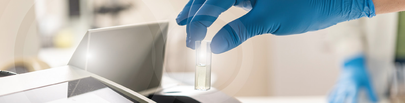 Βιολογικός έλεγχος Ανδρολογικό εργαστήριο Ζεγκινιάδου